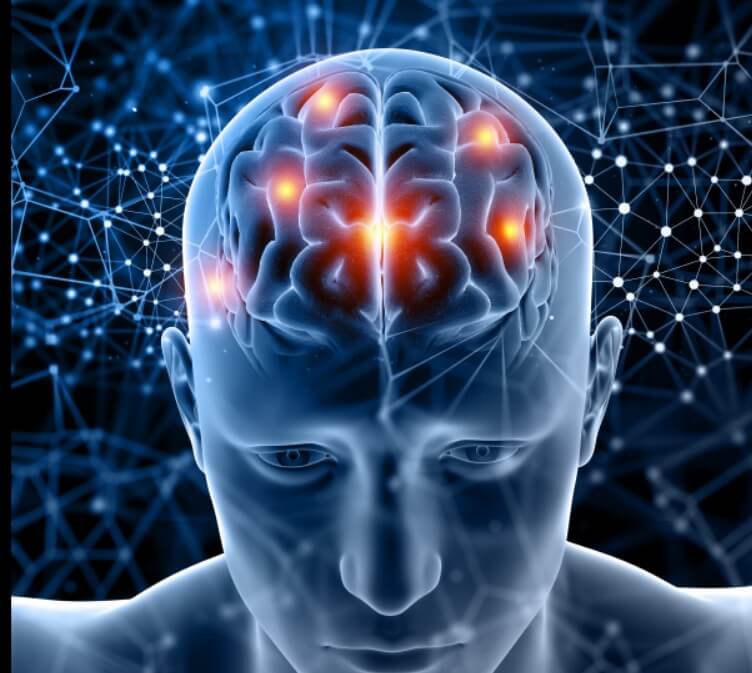 뇌경색 사진입니다.