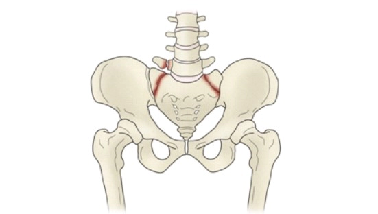 고아성 배우의 천추골 골절 부상