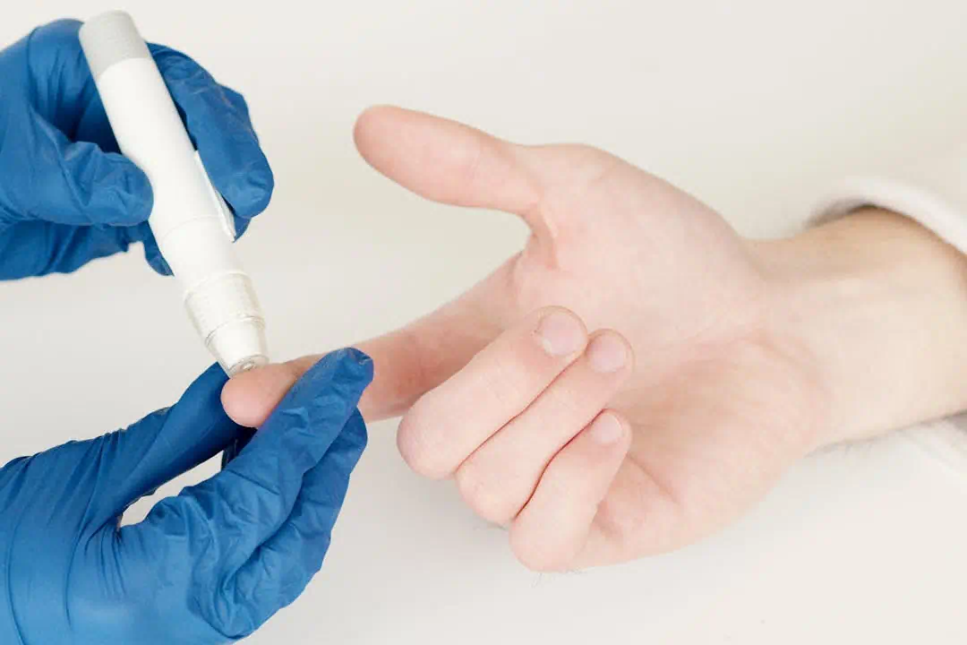 당뇨 혈당치료 관련사진8