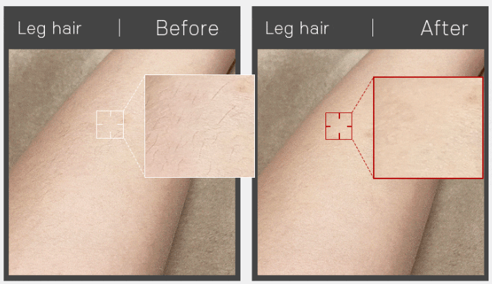 뷰앤디 눈썹 잔털 지우개