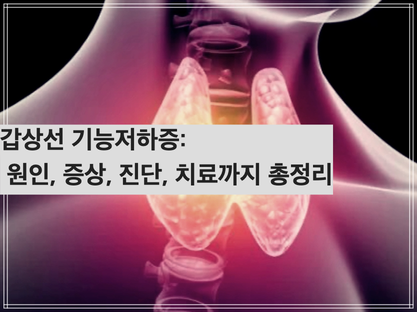 갑상선 기능저하증: 원인, 증상, 진단, 치료까지 총정리