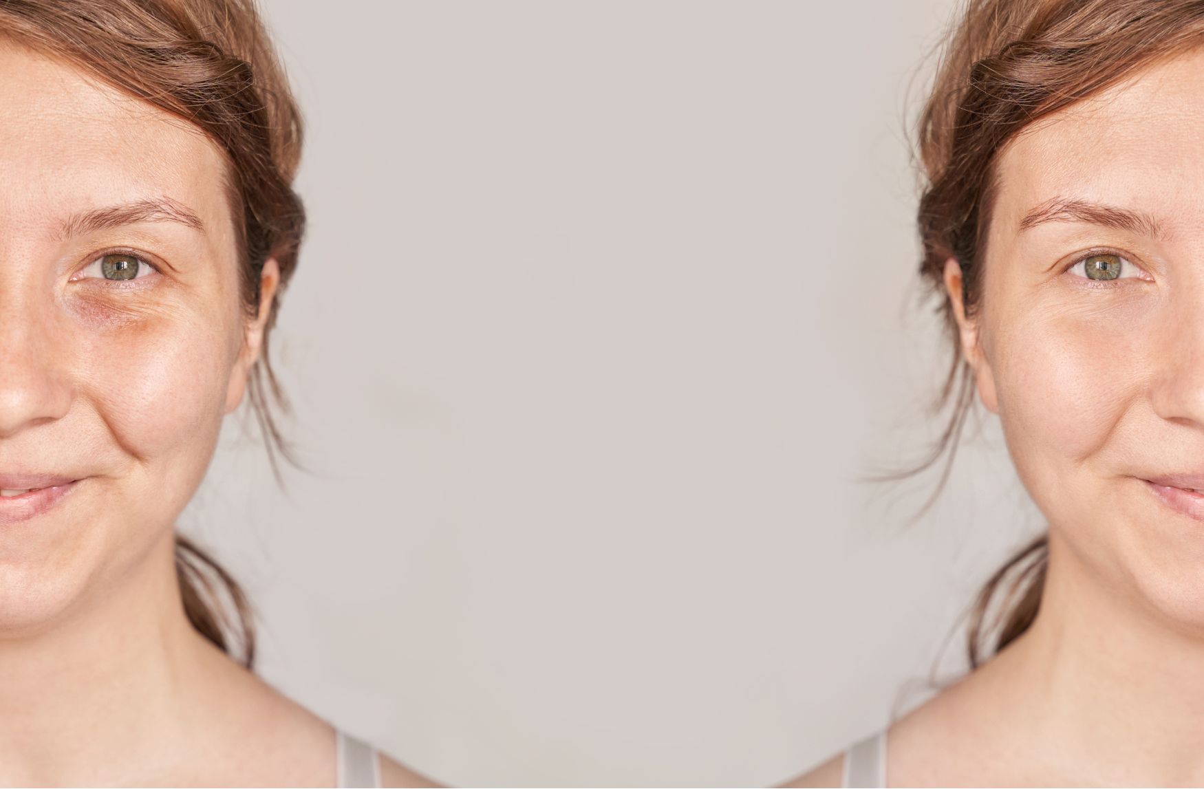 글루타치온 미백 효과