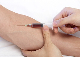 췌장암 검사방법