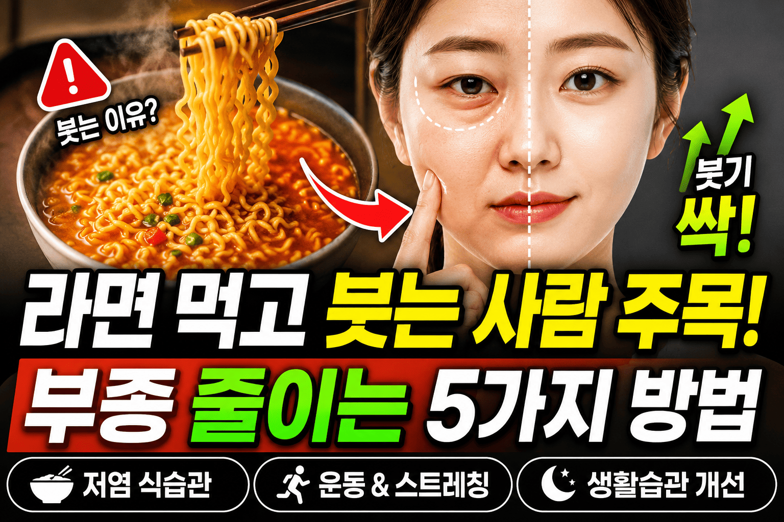 라면 부종 줄이는 방법 (저염, 운동, 생활습관)