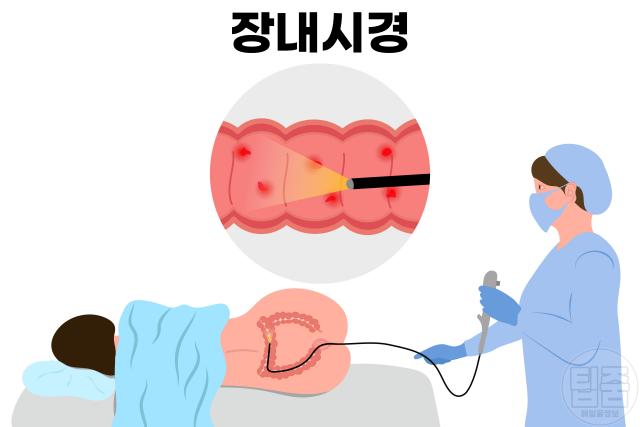 대장내시경 음식