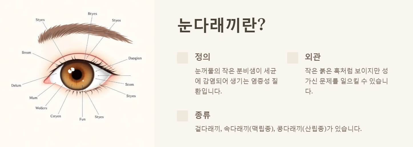 눈다래끼 원인 빨리 낫는 법