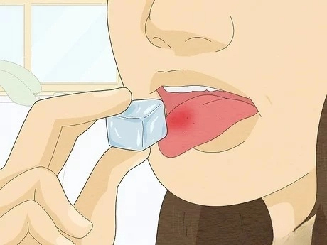 혓바늘이 돋는 이유 원인과 혓바늘 없애는 방법 꿀 치료법 자주돋는 현상