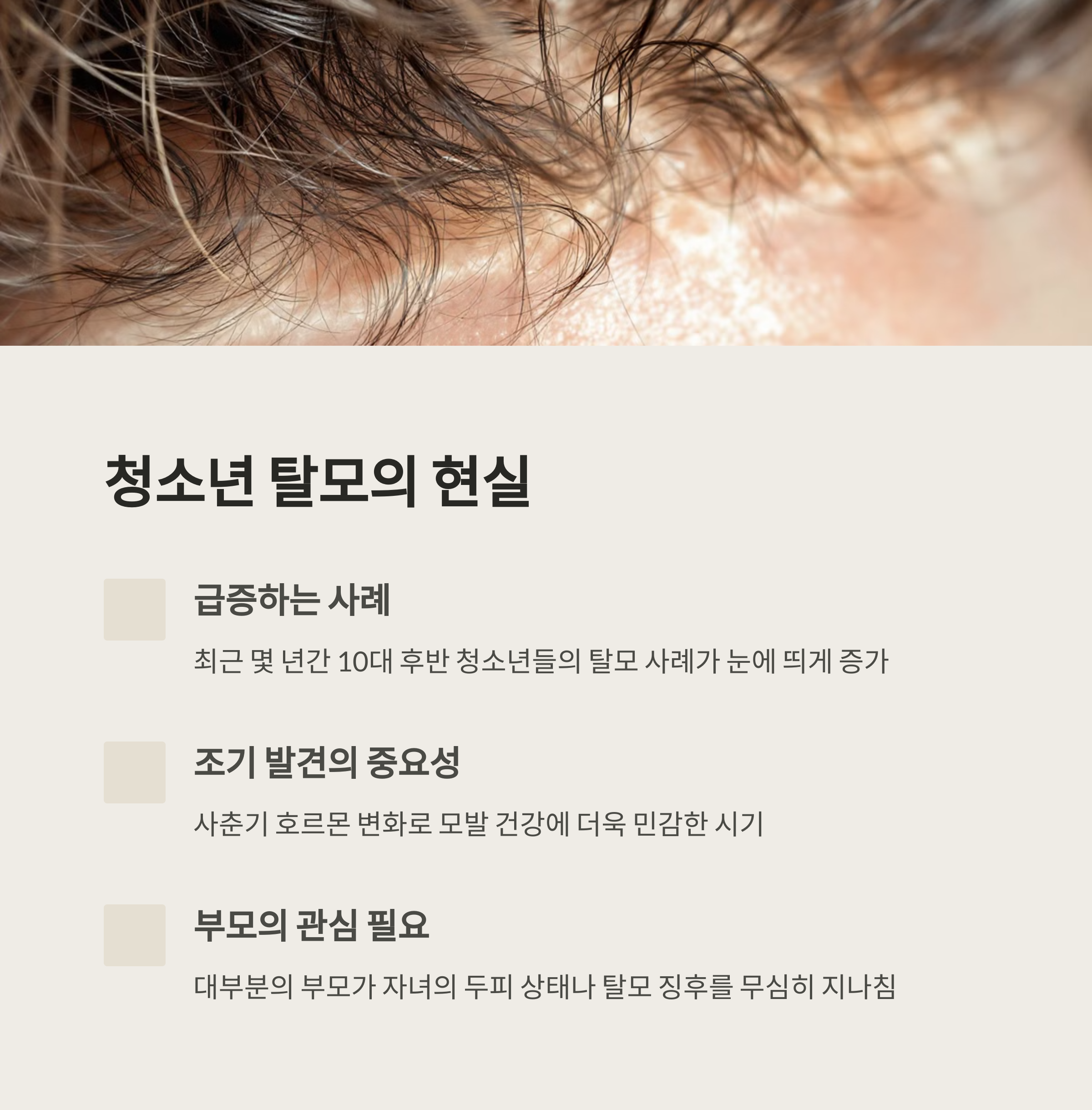 머리 두피사진 확대 이미지