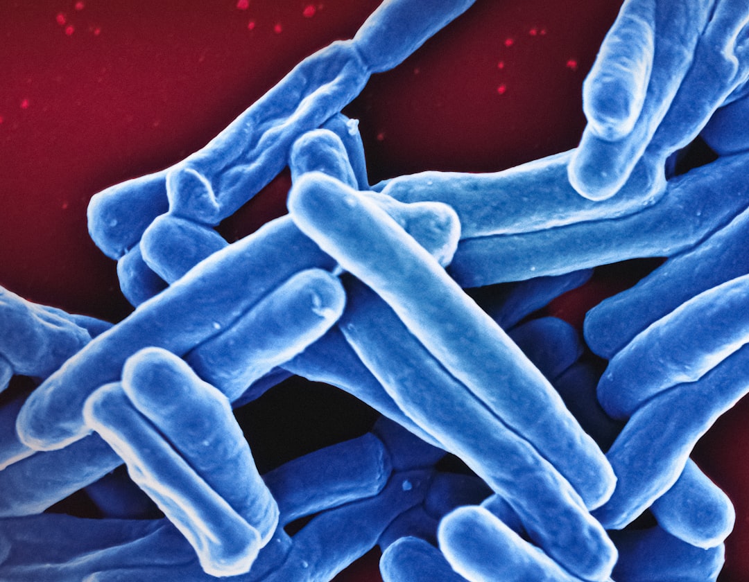 Latent tuberculosis