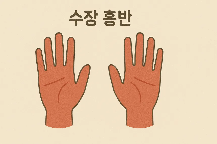 간경화 초기증상