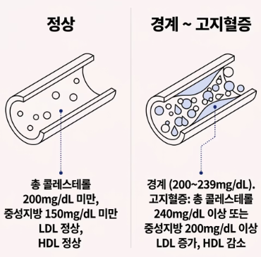 고지혈증에 좋은 음식