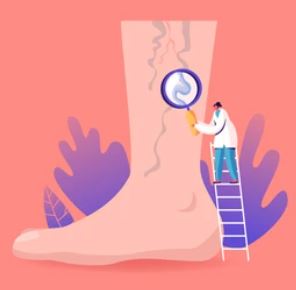 하지정맥류 증상