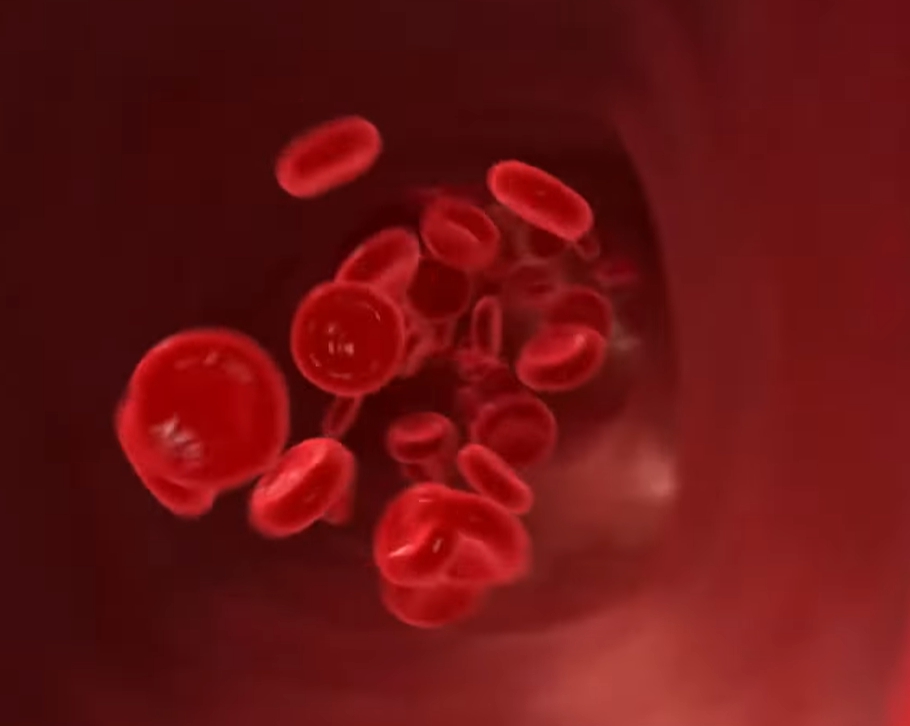 혈압 높을때 증상