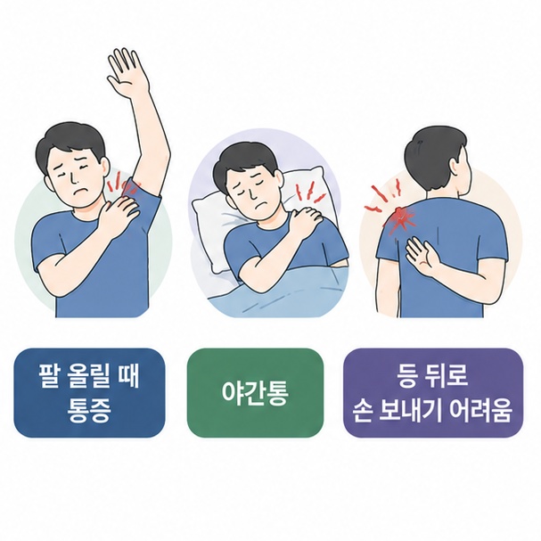 팔을 올릴 때 어깨가 아프고 밤에 통증이 심해지며 등 뒤로 손을 보내기 어려운 대표 증상을 보여주는 그림