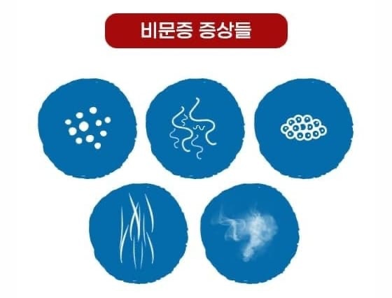 비문증약 비문증영양제