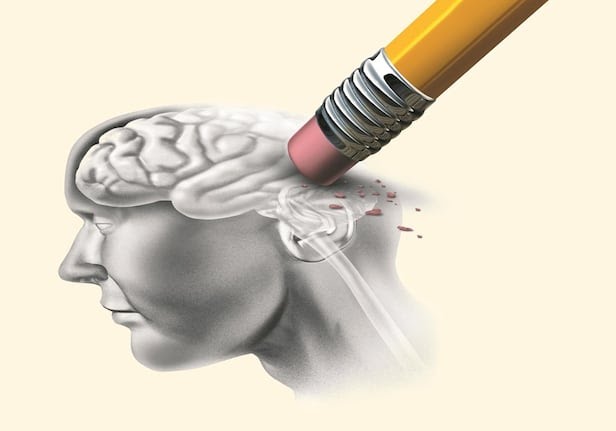 알츠하이머-백신-개발-접종방법-효과-상용화-제약사