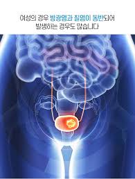 여성 방광염 증상