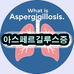 아스페르길루스증 증상, 아스페르길루스증 치료, 침습성 아스페르길루스증, 알레르기성 기관지폐 아스페르길루스증, 만성 폐 아스페르길루스증, 아스페르길루스증 자가 진단, 아스페르길루스증 예방 방법, 아스페르길루스 곰팡이 폐 감염, 아스페르길루스증 항진균제, 아스페르길루스증 위험군