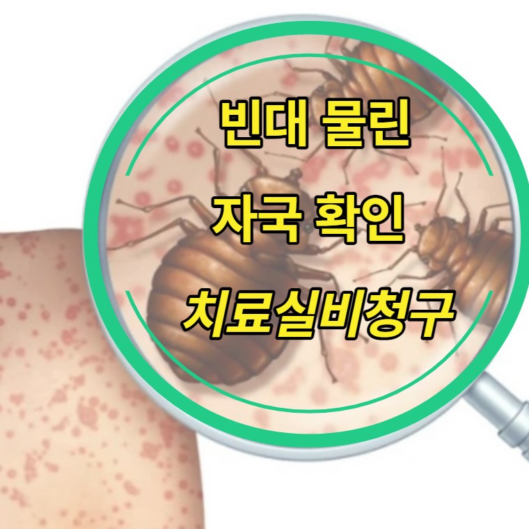 빈대물린자국