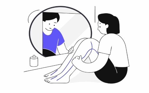 하지정맥류 원인과 의심증상