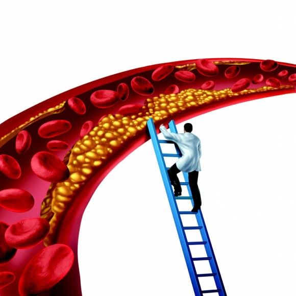 triglycerides 정상 수치