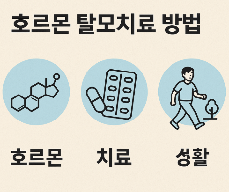 호르몬 탈모치료 방법