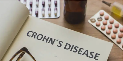 크론병