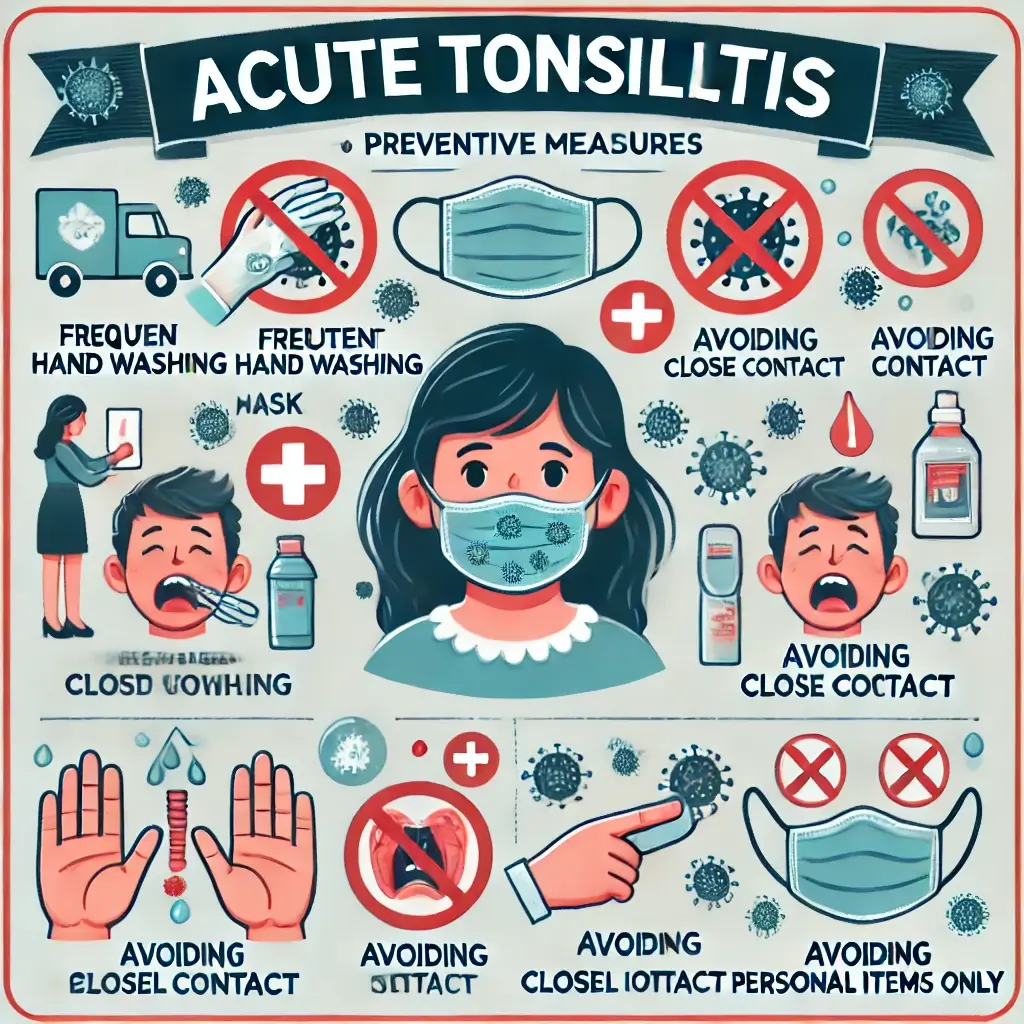 급성편도염의 치료