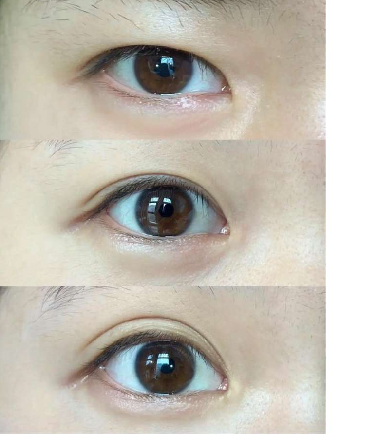 쏙빼스톤 사용법