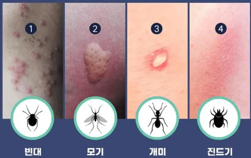 빈대 예방 및 퇴치