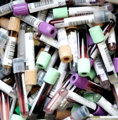 고지혈증 치료법 진단기준 예방