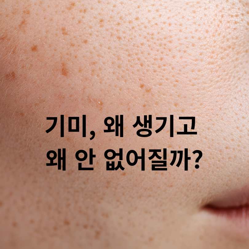 매스틱기미효능