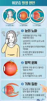 비문증