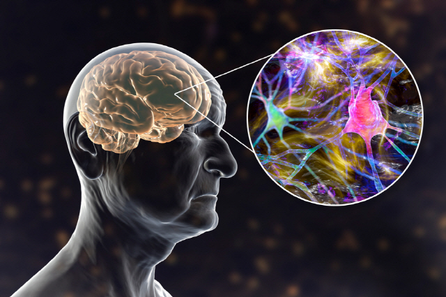 퇴행성 뇌질환 알츠하이머병의 예방과 식이요법