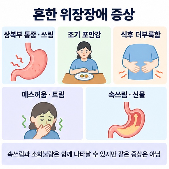 상복부 통증 조기 포만감 식후 더부룩함 메스꺼움 트림 속쓰림을 위장장애의 흔한 증상으로 정리한 인포그래픽
