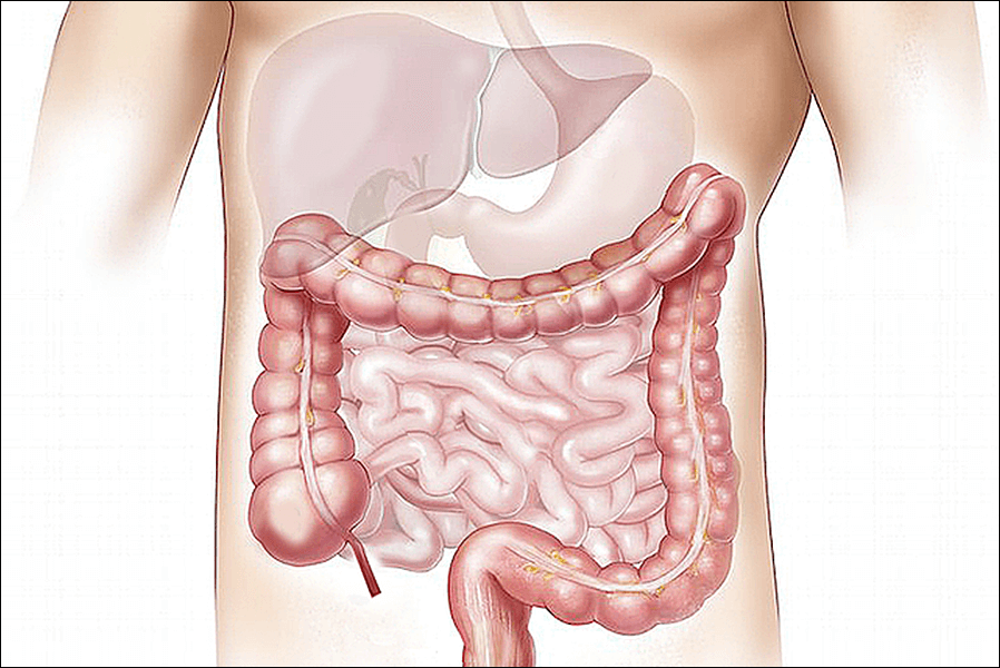 LGG 유산균 추천제품 및 효능