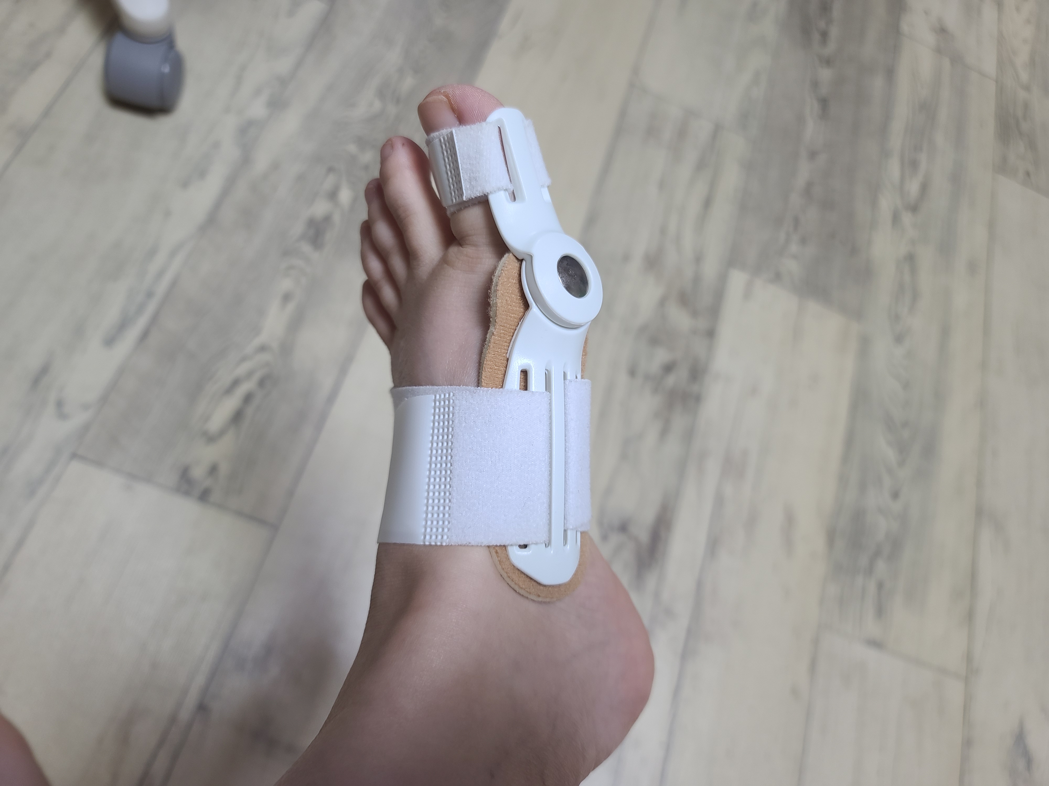 무지외반증 교정기