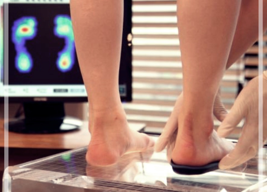 평발슬리퍼에 대한 이해