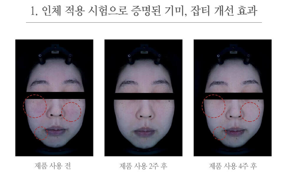 기미 크림 추천