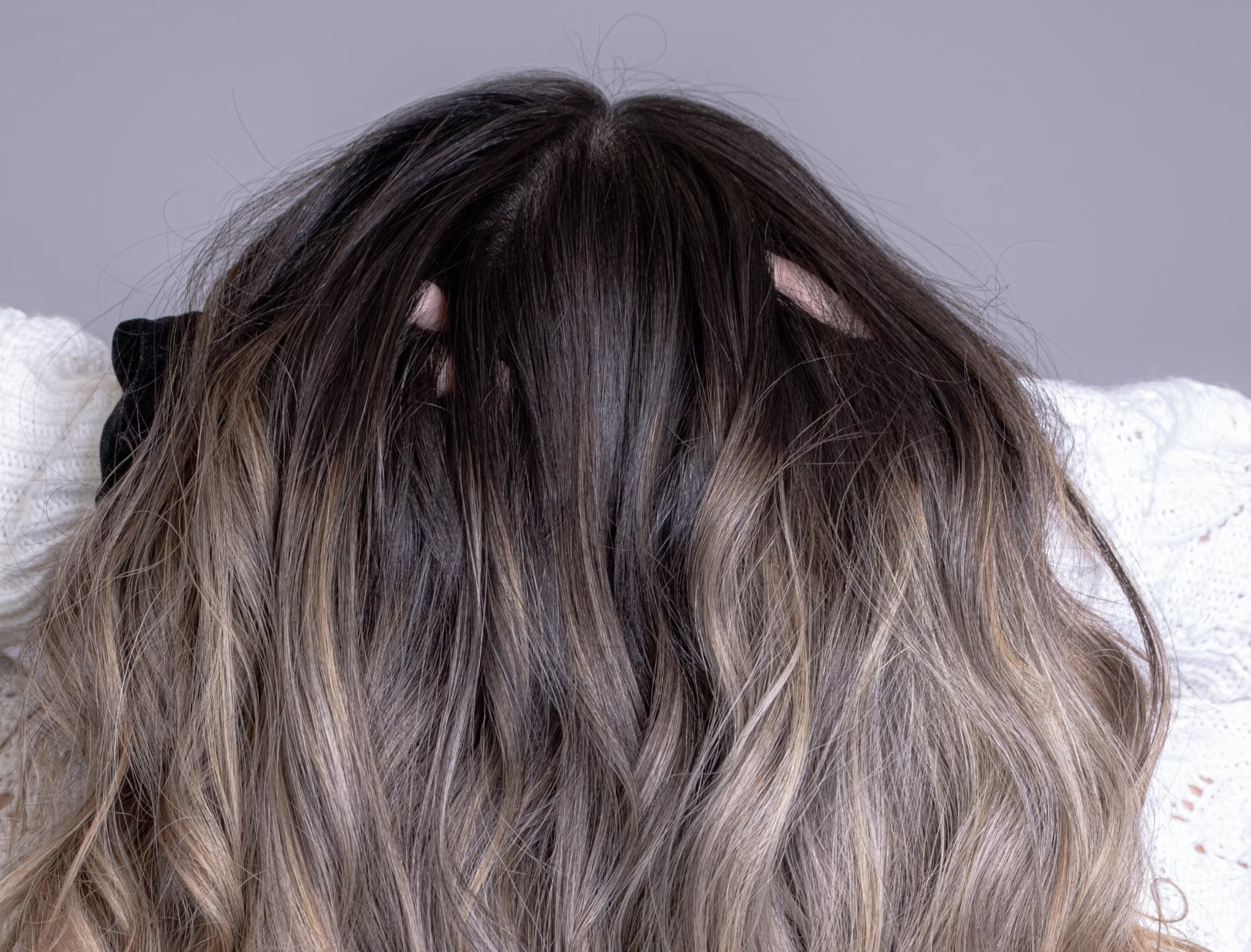 두피 모낭염 연고