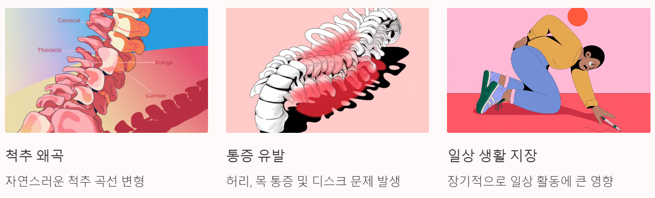 나쁜 자세가 척추에 미치는 영향의 시각적 자료