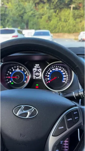 차에서 이상한 소리 엔진룸 탁탁 소음 원인과 수리 꿀팁에 대해_16