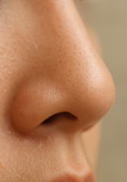 비립종 생기는 이유