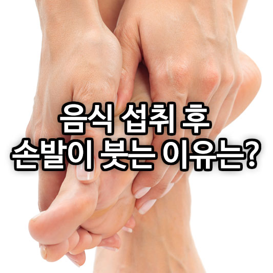 음식 섭취 후 손발이 붓는 이유는?