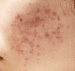 스킨 토너 바르는 이유