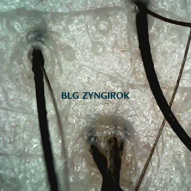 탈모 극복 프로젝트 - 뒷머리 두피 사진 모습이다.