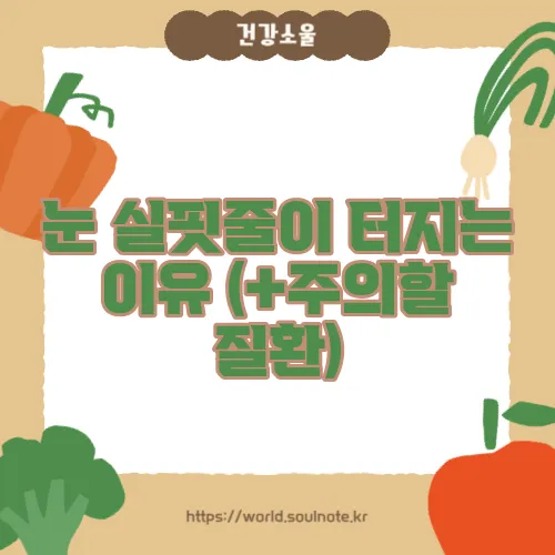 눈 실핏줄이 터지는 이유 (+주의할 질환)