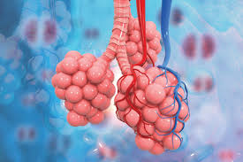 폐에 물이 차는 원인