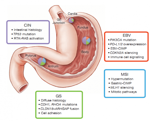 4기 위암의 생존율