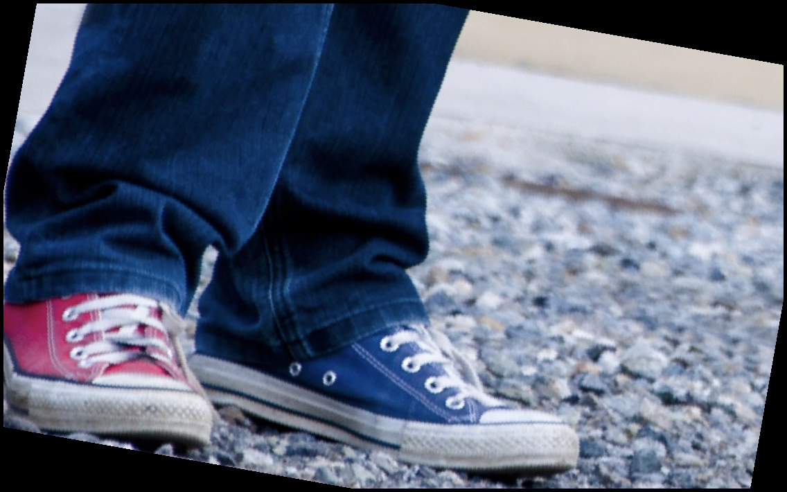 내성발톱 자가치료